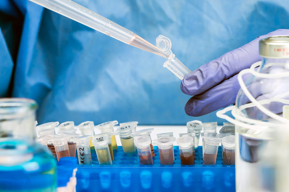 AOX in Wastewater: How to Remove Adsorbable Organic Halides and Meet Discharge Limits - Puragen